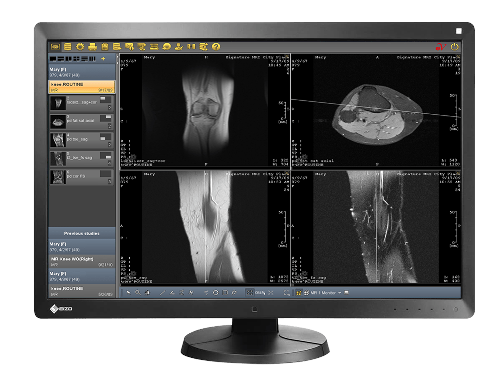 SepStream PACS: Tailored Diagnostic Imaging Solutions